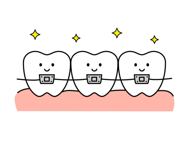 矯正の種類はどんなのがあるの？
